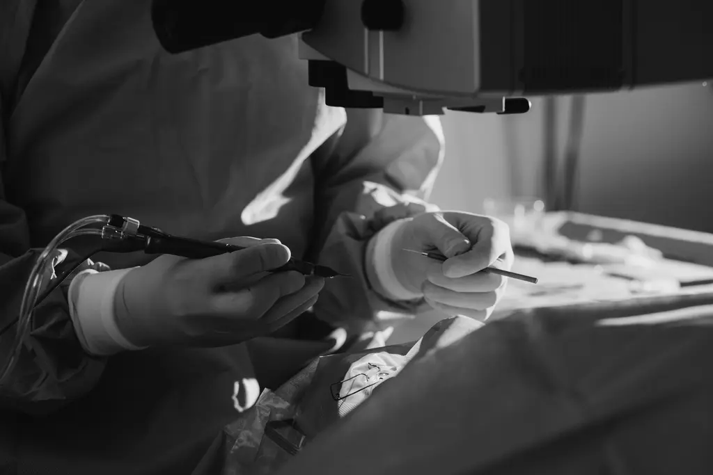 Cirurgia de Catarata